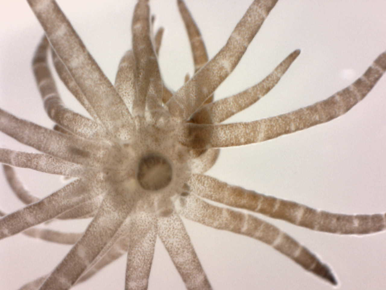 Muddy Shore Anemone